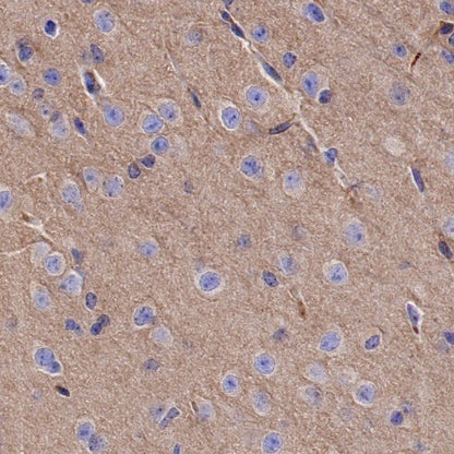 α-tubulin Rabbit Polyclonal Antibody