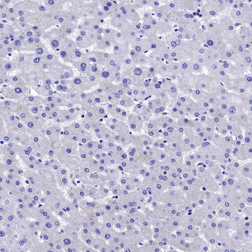 MEK1/2 Recombinant Rabbit mAb (S-834-101)