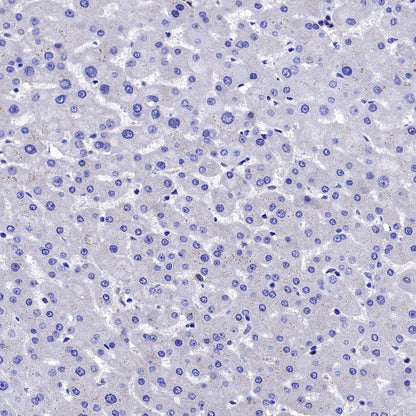MEK1/2 Recombinant Rabbit mAb (S-834-101)