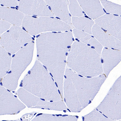 CD37 Recombinant Rabbit mAb (S-1662-61)