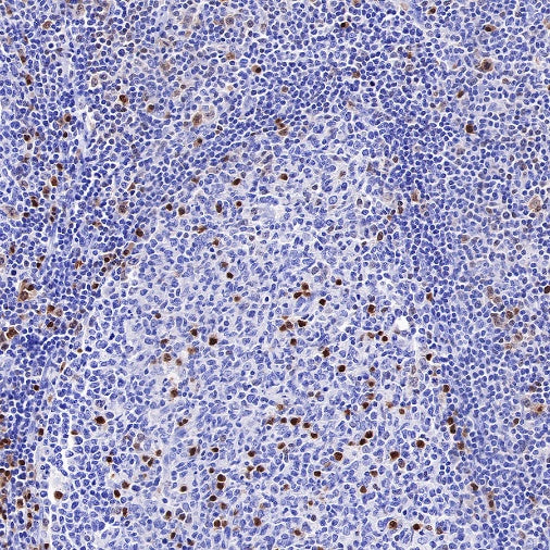 IRF4 Recombinant Rabbit mAb (S-654-33)