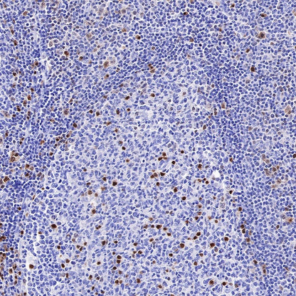 IRF4 Recombinant Rabbit mAb (S-654-33)