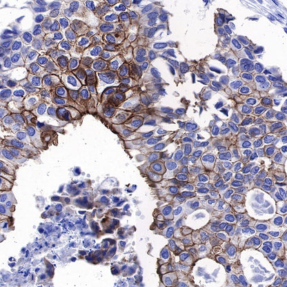 ErbB4 Recombinant Rabbit mAb (S-496-61)
