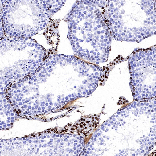 Histone H3 (di methyl K56) Recombinant Rabbit mAb (S-R427)
