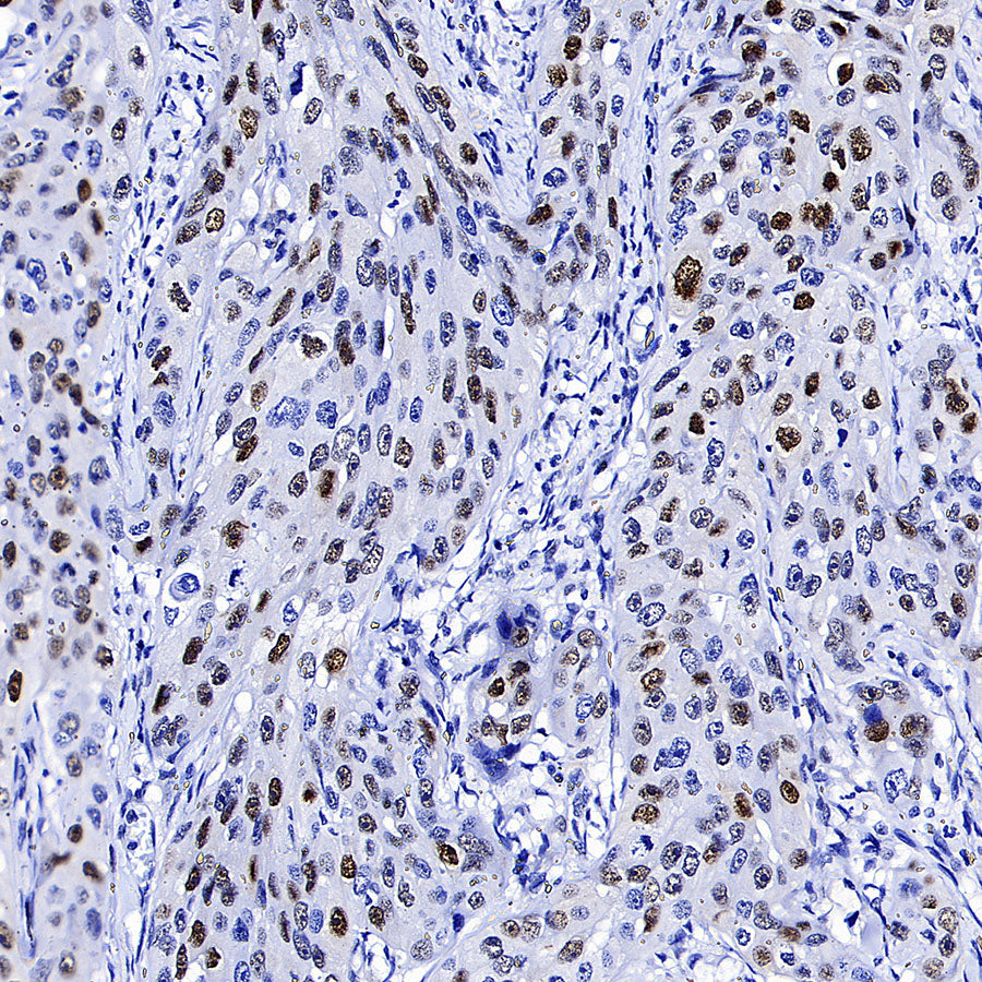 Cyclin E1 Recombinant Rabbit mAb (SDT-4375-44)