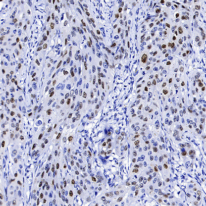Cyclin E1 Recombinant Rabbit mAb (SDT-4375-44)