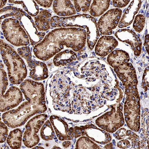 Fumarate hydratase Recombinant Rabbit mAb (SDT-2434-54)