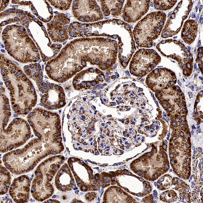 Fumarate hydratase Recombinant Rabbit mAb (SDT-2434-54)