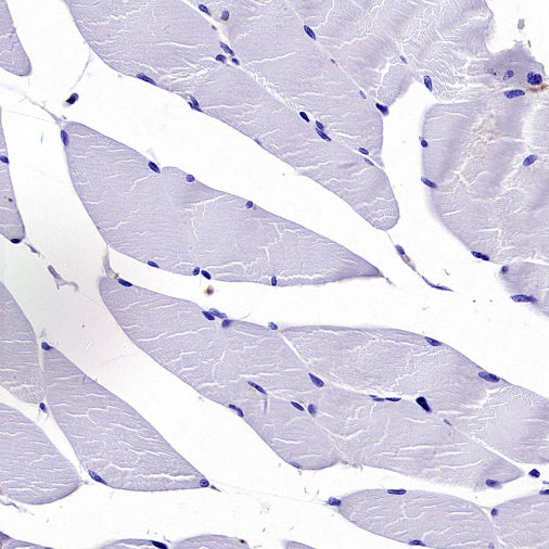 Human IgA1 Recombinant Rabbit mAb (S-2513-50)