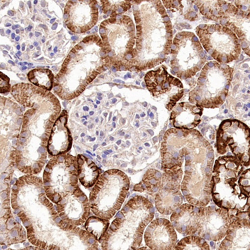 TMEM106B Recombinant Rabbit mAb (S-2362-33)