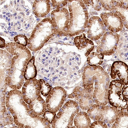 TMEM106B Recombinant Rabbit mAb (S-2362-33)