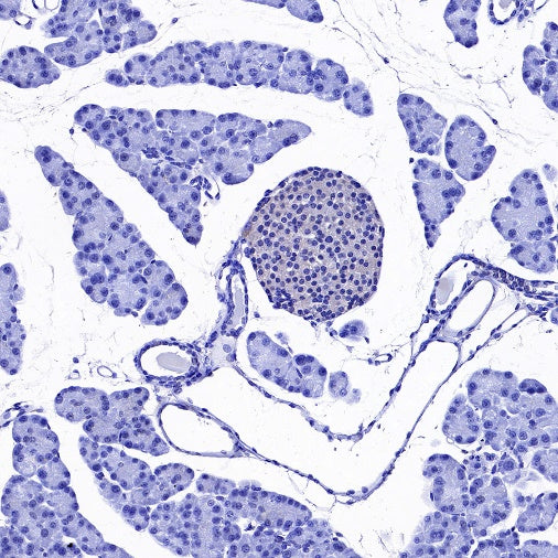 GAD65 Recombinant Rabbit mAb (S-2318-47)