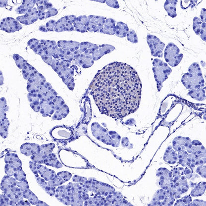 GAD65 Recombinant Rabbit mAb (S-2318-47)