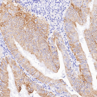 Jak1 Recombinant Rabbit mAb (S-4201)