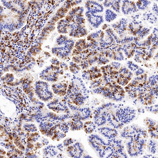 QPRT Recombinant Rabbit mAb (S-1228-31)