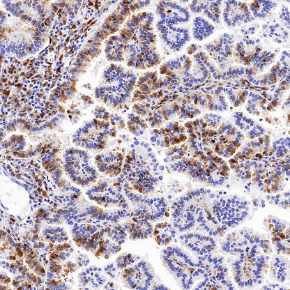 QPRT Recombinant Rabbit mAb (S-1228-31)