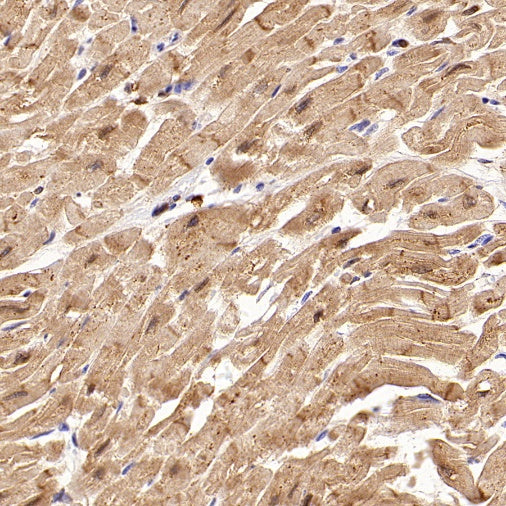 SFRP1 Recombinant Rabbit mAb (S-3071-18)