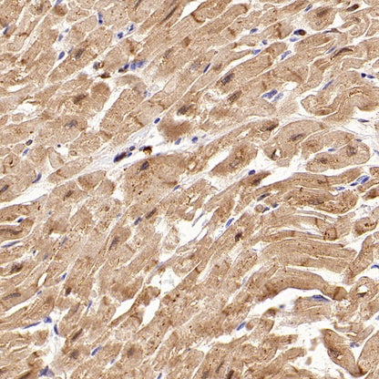 SFRP1 Recombinant Rabbit mAb (S-3071-18)