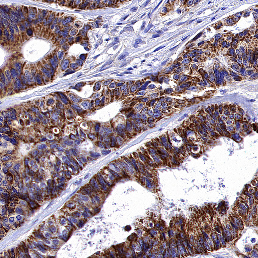 Aldh5a1 Recombinant Rabbit mAb (S-4135-76)