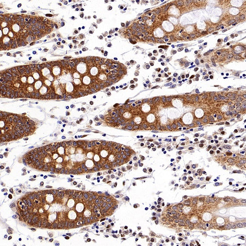 SLC12A2 Recombinant Rabbit mAb (S-2437-30)
