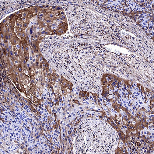 AACT Recombinant Rabbit mAb (S-897-109)