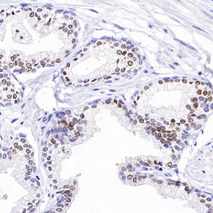 NKX3.1 Recombinant Rabbit mAb (S-2778-63)