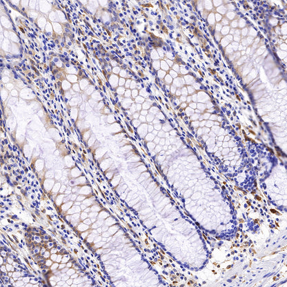 STING Recombinant Rabbit mAb (SDT-R150)