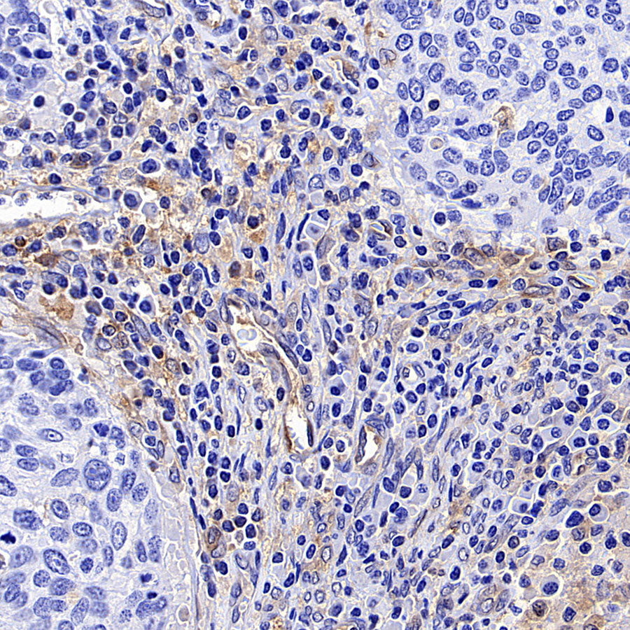 IFIT1 Recombinant Rabbit mAb (S-5120)
