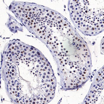 RNF40 Recombinant Rabbit mAb (S-1068-279)