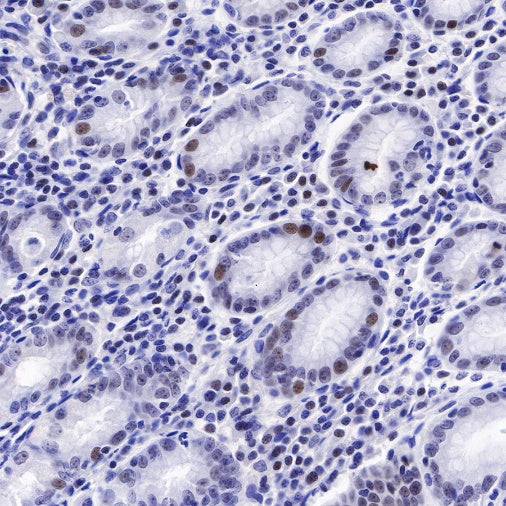 Nucleophosmin/NPM Recombinant Rabbit mAb (S-R231)