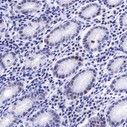 Nucleophosmin/NPM Recombinant Rabbit mAb (S-R231)