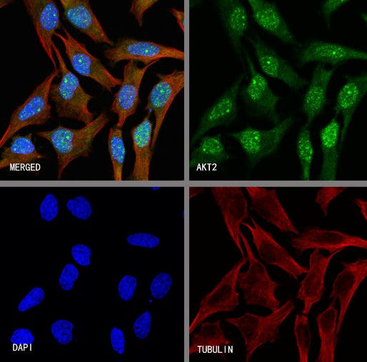 AKT2 Recombinant Rabbit mAb (S-2617-6)
