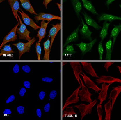 AKT2 Recombinant Rabbit mAb (S-2617-6)