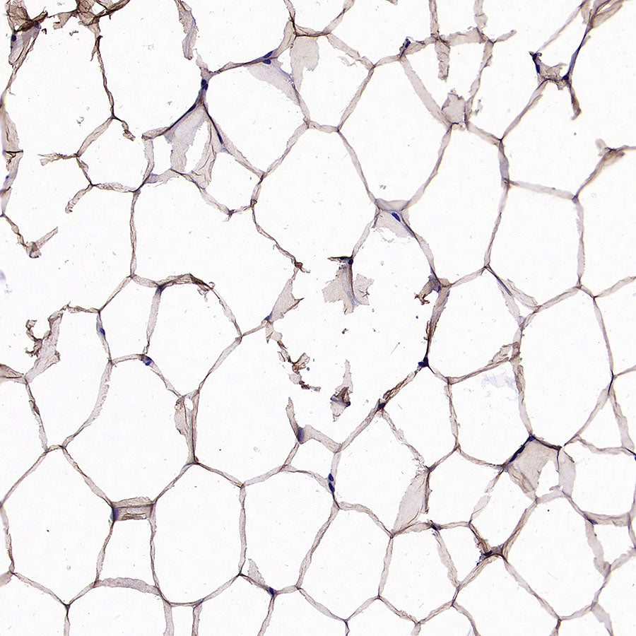 PNPLA2 Recombinant Rabbit mAb (S-5409)