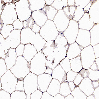 PNPLA2 Recombinant Rabbit mAb (S-5409)