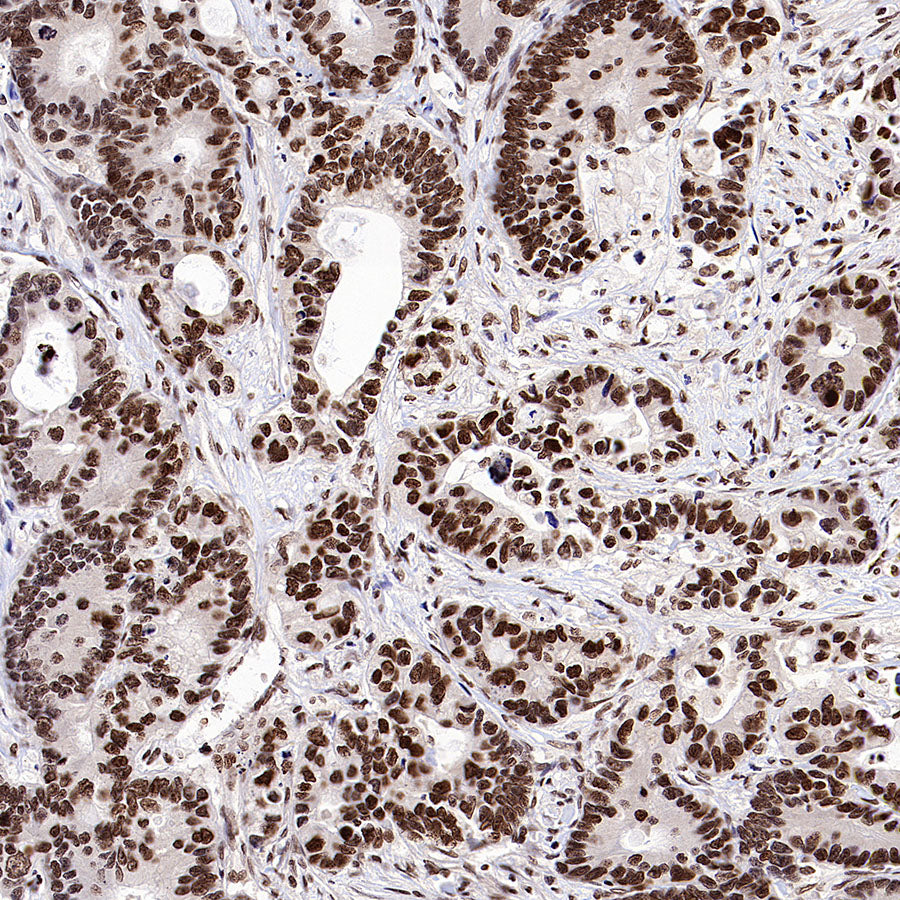 L-Lactyl Lysine Rabbit mAb