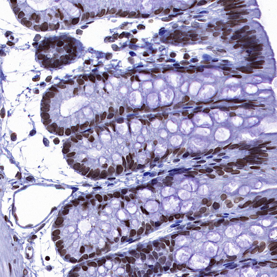 Histone H3 Recombinant Rabbit mAb (S-5672)