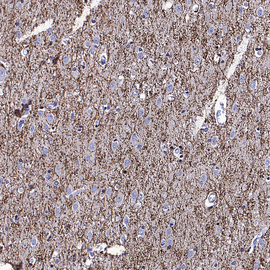 SIRT2 Mouse mAb
