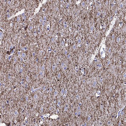 SIRT2 Mouse mAb