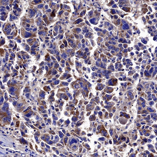 Neuropilin 1 Recombinant Rabbit mAb (S-1453-6)