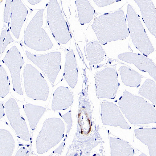 TAGLN/Transgelin Recombinant Rabbit mAb (S-1715-59)