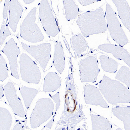 TAGLN/Transgelin Recombinant Rabbit mAb (S-1715-59)
