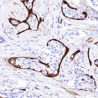 Myosin-11/SMMHC Recombinant Rabbit mAb,PBS Only (SDT-188-112)