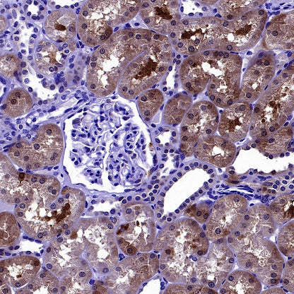 PSAP Recombinant Rabbit mAb (S-2399-11)
