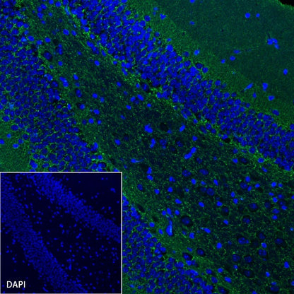 GAP43 Rabbit Polyclonal Antibody-Neuronal Marker