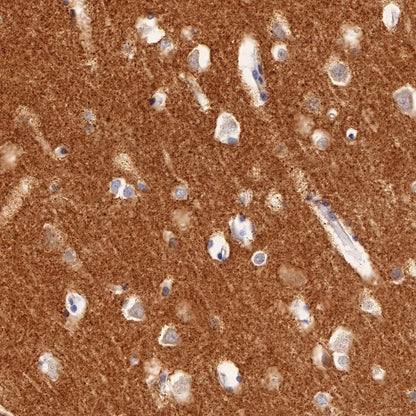 Synapsin-1 Recombinant Rabbit mAb (S-550-7)