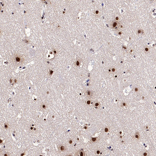 SF2 Recombinant Rabbit mAb (S-1845-27)