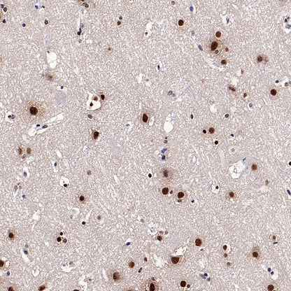 SF2 Recombinant Rabbit mAb (S-1845-27)