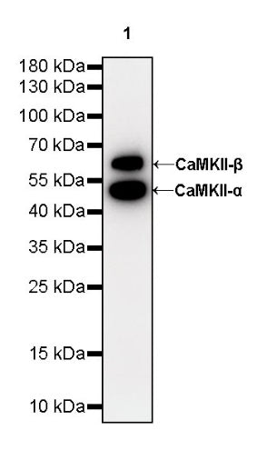 CaMKII-α/β Recombinant Rabbit mAb (S-R329)