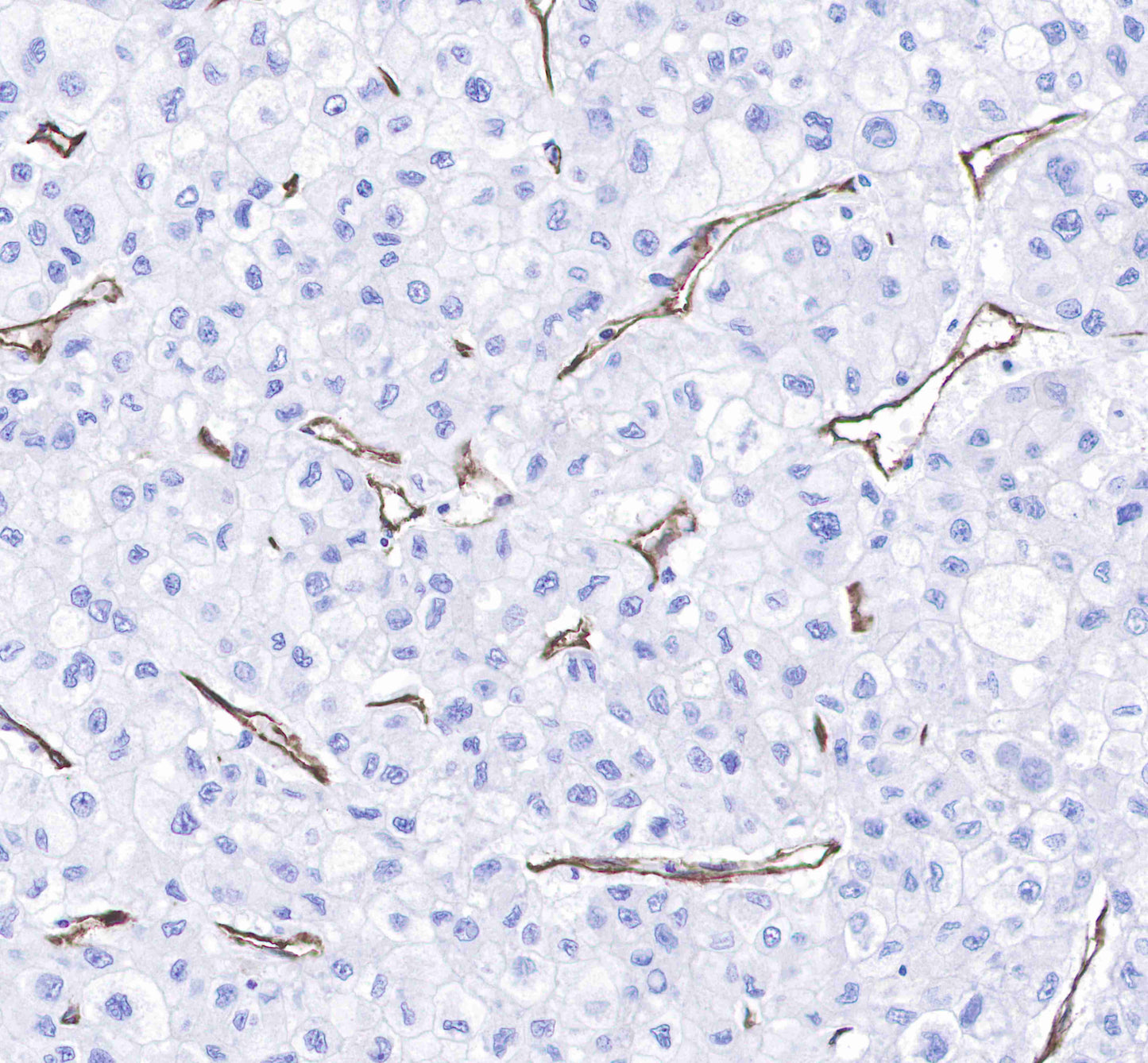 CD31 Recombinant Rabbit mAb,PBS Only (SDT-008-17)
